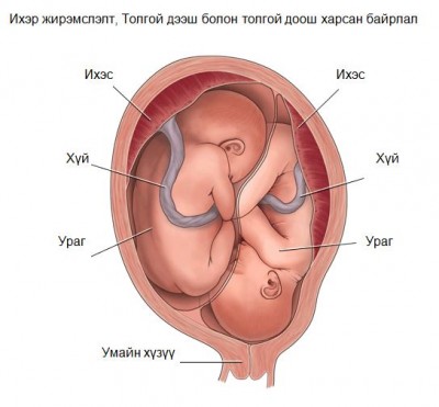 Зураг 1