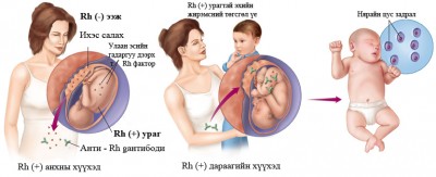 Резус антиген
