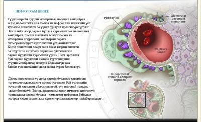 Нефроз хам шинж б