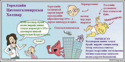 ЦМВ